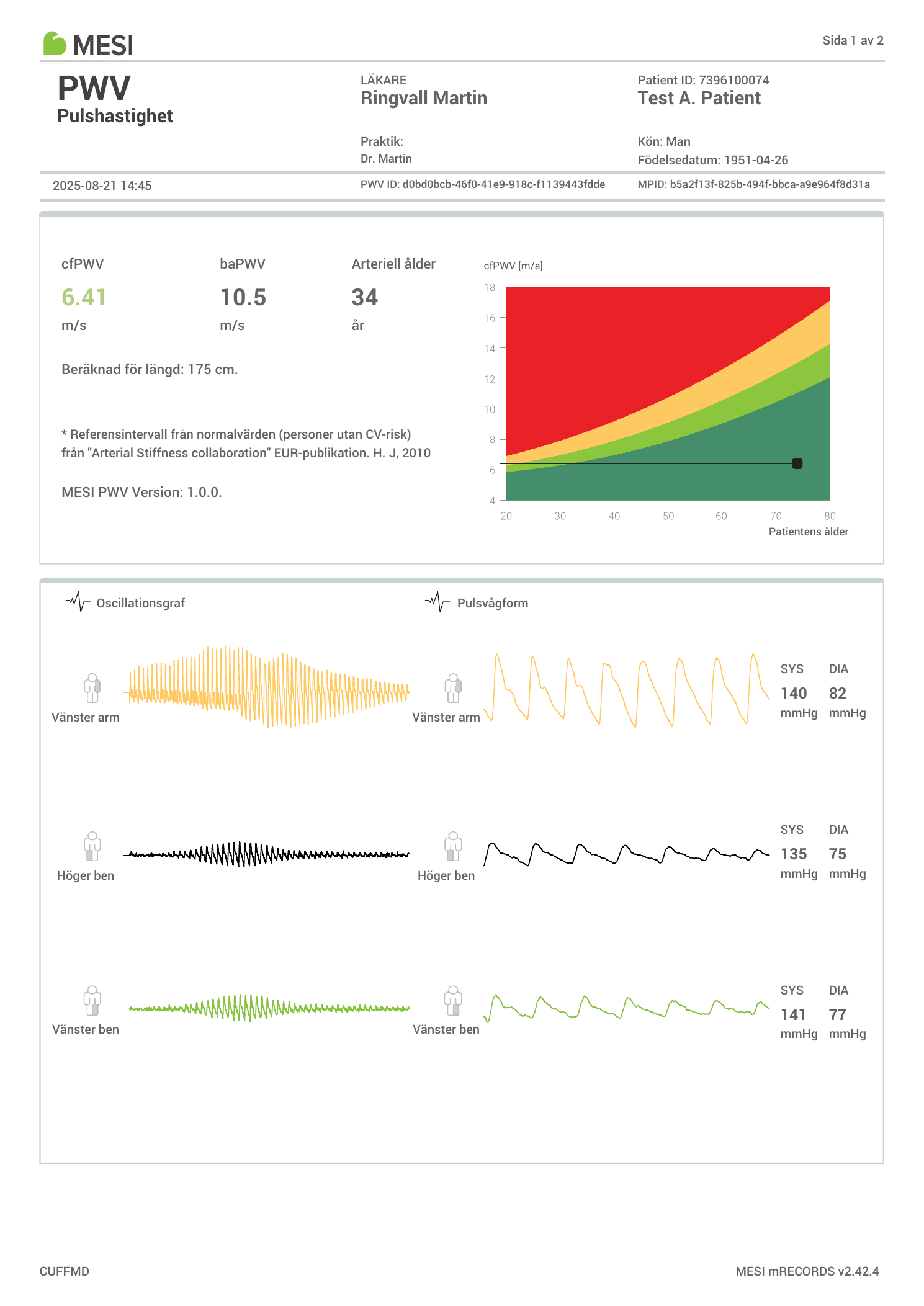 PWV-rapport sida 1 – cfPWV 6,41 m/s, baPWV 10,5 m/s, arteriell ålder 34 år, oscillationsgrafer arm och ben