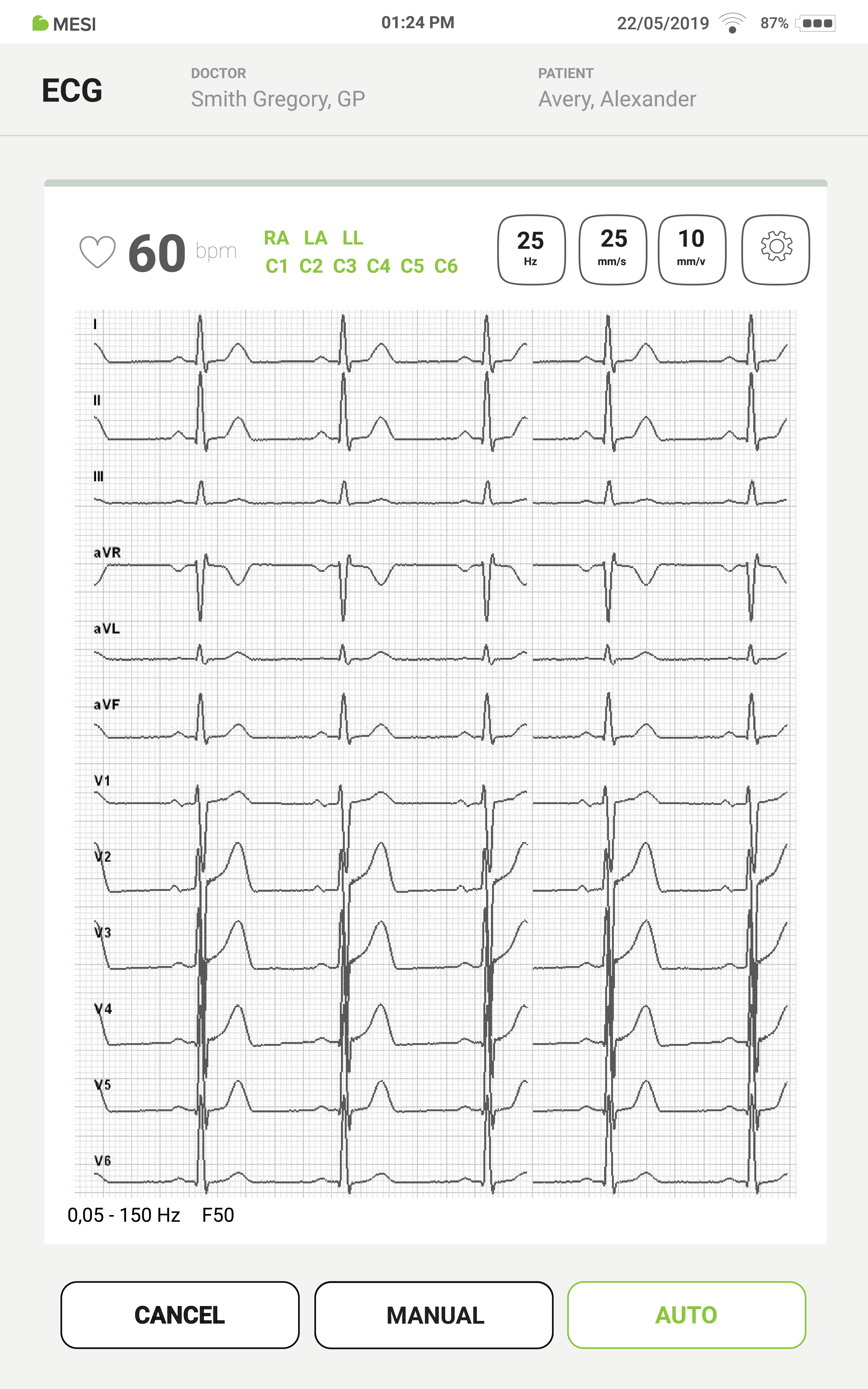MESI mTABLET ECG – 12-avlednings EKG-rapport på skärm