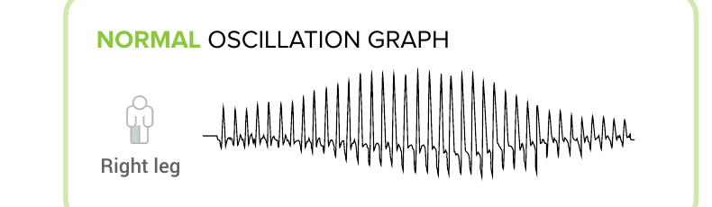 Normal oscillationsgraf
