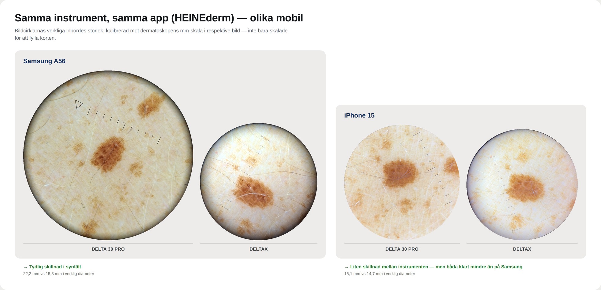 Jämförelse: DELTA 30 PRO och DELTAX fotograferade med samma app (HEINEderm) på Samsung A56 respektive iPhone 15