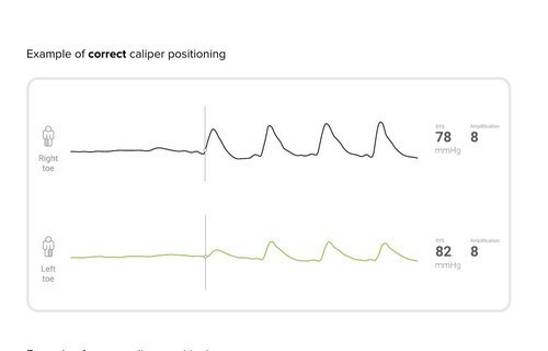 Korrekt placering av mätlinjen
