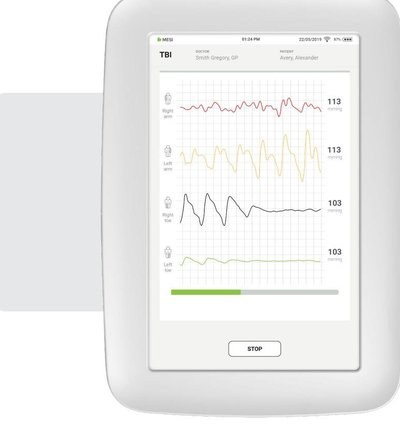Under mätningen – pulsvågsgrafer och realtidsdata