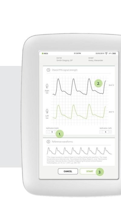 Pulsvågsgraferna ska vara jämna och tydliga innan mätningen startas